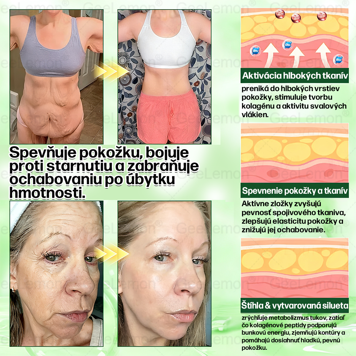 💎Odporúčané UNB · 👩‍⚕️Oficiálny obchod Dr. Max | 🎁 𝐆𝐞𝑒𝐿𝑒𝐦𝐨𝐧® Glumasetide 8 v 1 Nano mikrotŕňový náplasť – Len raz denne ✅ Viditeľné zmeny za 7 dní na obezitu, ochabnutú pokožku a zdravie