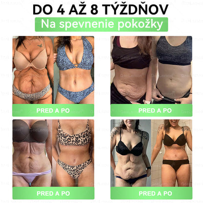 💎Odporúčané UNB · 👩‍⚕️Oficiálny obchod Dr. Max | 🎁 𝐆𝐞𝑒𝐿𝑒𝐦𝐨𝐧® Glumasetide 8 v 1 Nano mikrotŕňový náplasť – Len raz denne ✅ Viditeľné zmeny za 7 dní na obezitu, ochabnutú pokožku a zdravie