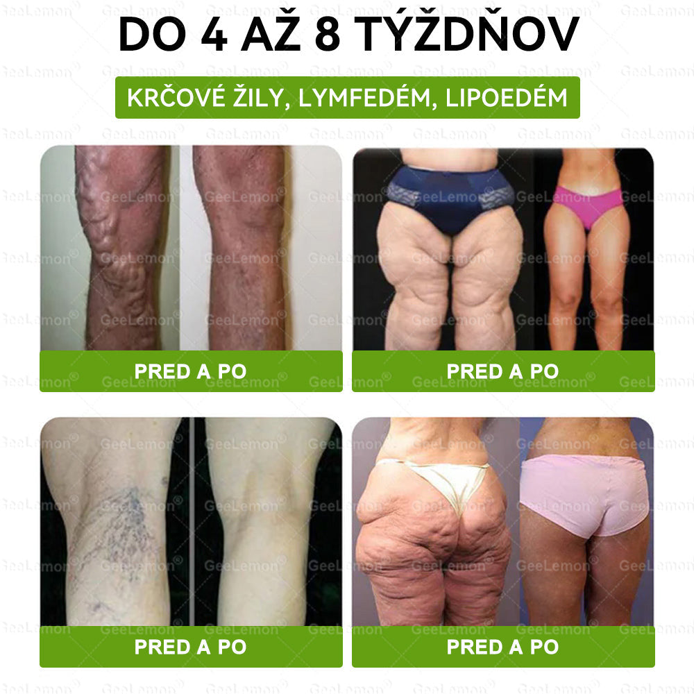 💎Odporúčané UNB · 👩‍⚕️Oficiálny obchod Dr. Max | 🎁 𝐆𝐞𝑒𝐿𝑒𝐦𝐨𝐧® Glumasetide 8 v 1 Nano mikrotŕňový náplasť – Len raz denne ✅ Viditeľné zmeny za 7 dní na obezitu, ochabnutú pokožku a zdravie
