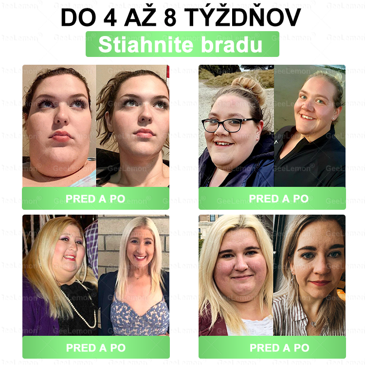 💎Odporúčané UNB · 👩‍⚕️Oficiálny obchod Dr. Max | 🎁 𝐆𝐞𝑒𝐿𝑒𝐦𝐨𝐧® Glumasetide 8 v 1 Nano mikrotŕňový náplasť – Len raz denne ✅ Viditeľné zmeny za 7 dní na obezitu, ochabnutú pokožku a zdravie